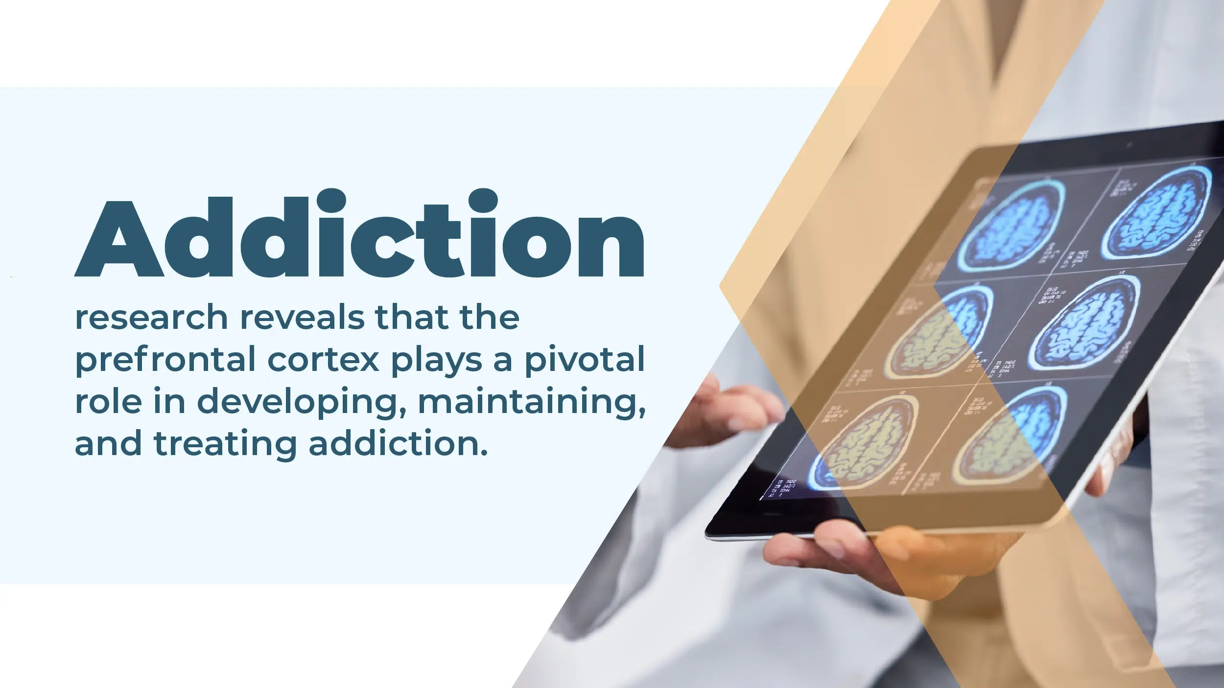 Brain scans. Addiction research reveals that the prefrontal cortex plays a pivotal role in developing, maintaining, and treating addiction.
